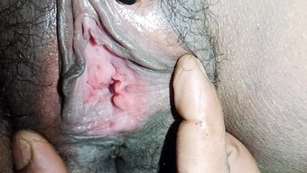 Yaralanma,...